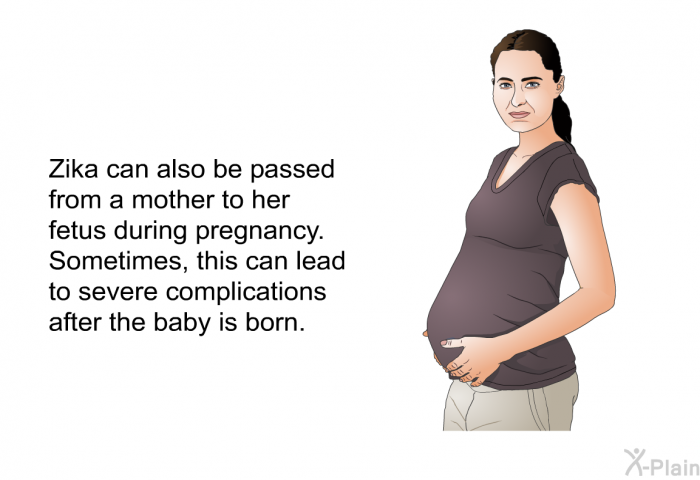 Zika can also be passed from a mother to her fetus during pregnancy. Sometimes, this can lead to severe complications after the baby is born.