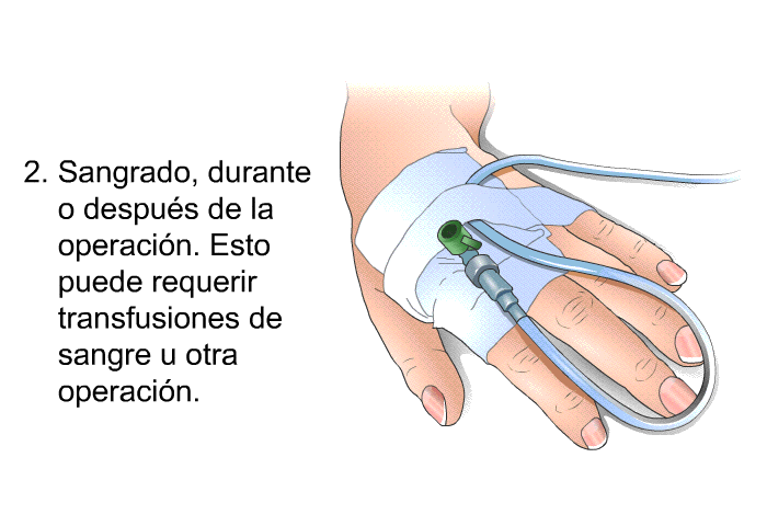 Sangrado, durante o despus de la operacin. Esto puede requerir transfusiones de sangre u otra operacin.