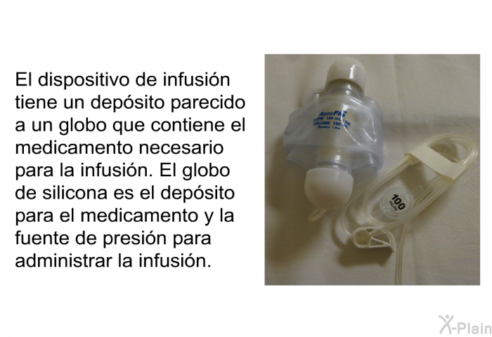 El dispositivo de infusin tiene un depsito parecido a un globo que contiene el medicamento necesario para la infusin. El globo de silicona es el depsito para el medicamento y la fuente de presin para administrar la infusin.