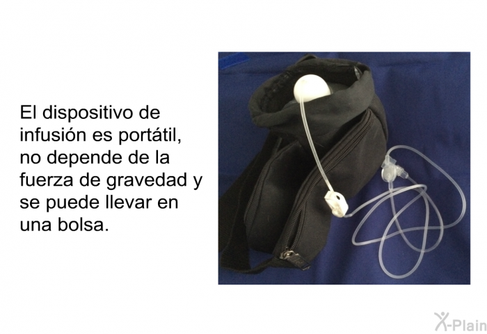 El dispositivo de infusin es porttil, no depende de la fuerza de gravedad y se puede llevar en una bolsa.