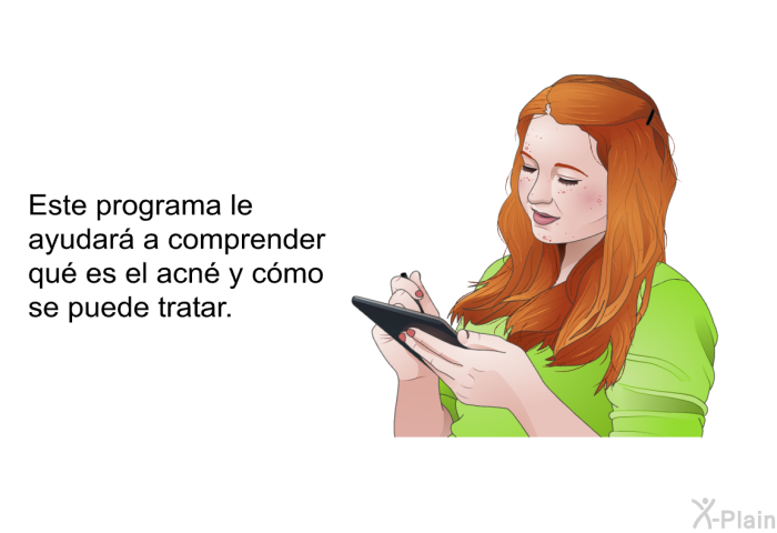 Este informacin acerca de su salud le ayudar a comprender qu es el acn y cmo se puede tratar.