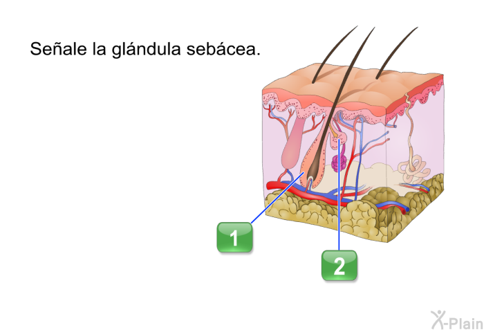 Seale la glndula sebcea.