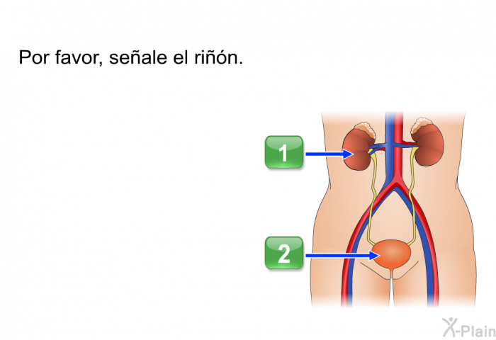 Por favor, seale el rin.