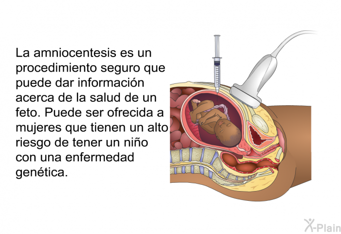 La amniocentesis es un procedimiento seguro que puede dar informaci�n acerca de la salud de un feto. Puede ser ofrecida a mujeres que tienen un alto riesgo de tener un ni�o con una enfermedad gen�tica.