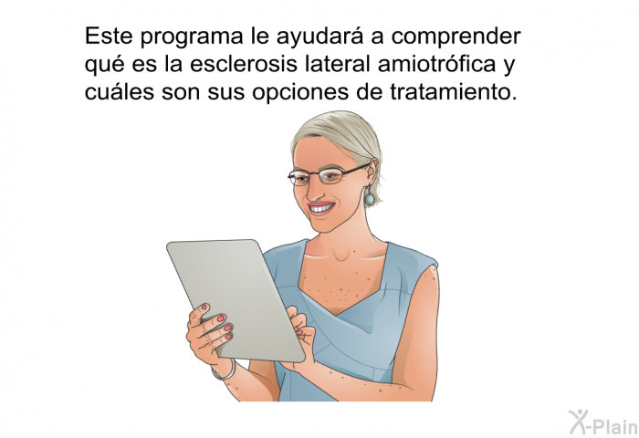 Esta informacin acerca de su salud le ayudar a comprender qu es la esclerosis lateral amiotrfica y cules son sus opciones de tratamiento.