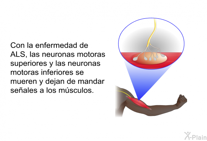 Con la enfermedad de ALS, las neuronas motoras superiores y las neuronas motoras inferiores se mueren y dejan de mandar seales a los msculos.