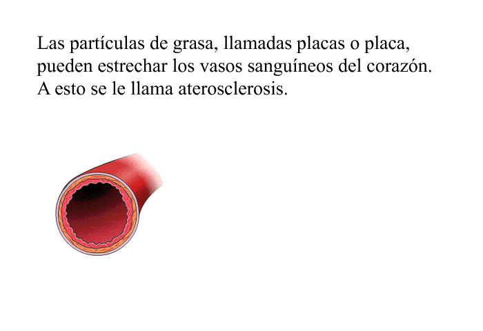 Las partculas de grasa, llamadas placas o placa, pueden estrechar los vasos sanguneos del corazn. A esto se le llama <I>aterosclerosis</I>.