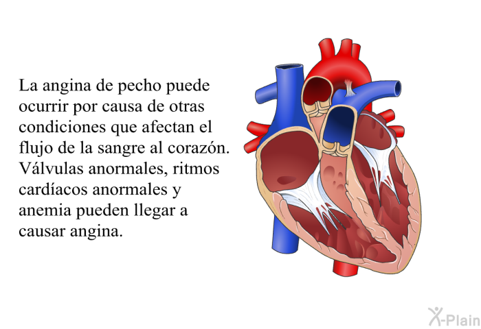 La angina de pecho puede ocurrir por causa de otras condiciones que afectan el flujo de la sangre al corazn. Vlvulas anormales, ritmos cardacos anormales y anemia pueden llegar a causar angina.