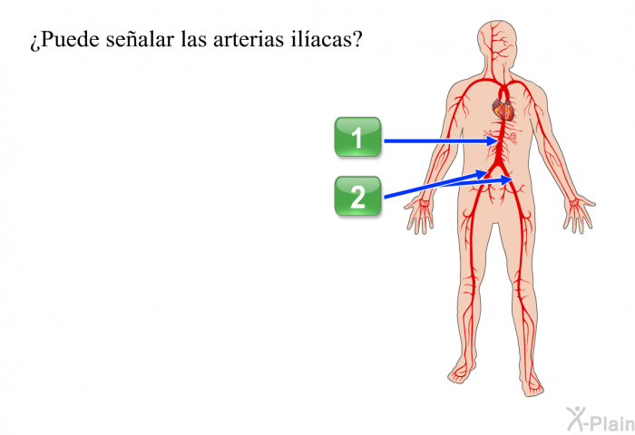 ¿Puede sealar las arterias ilacas? 