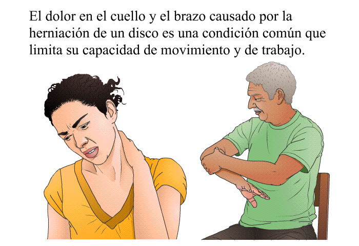 El dolor en el cuello y el brazo causado por la herniacin de un disco es una condicin comn que limita su capacidad de movimiento y de trabajo.