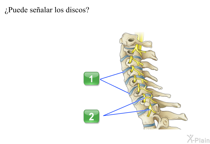 ¿Puede sealar los discos?