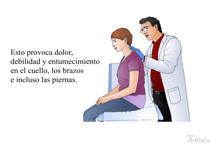 Esto provoca dolor, debilidad y entumecimiento en el cuello, los brazos e incluso las piernas.