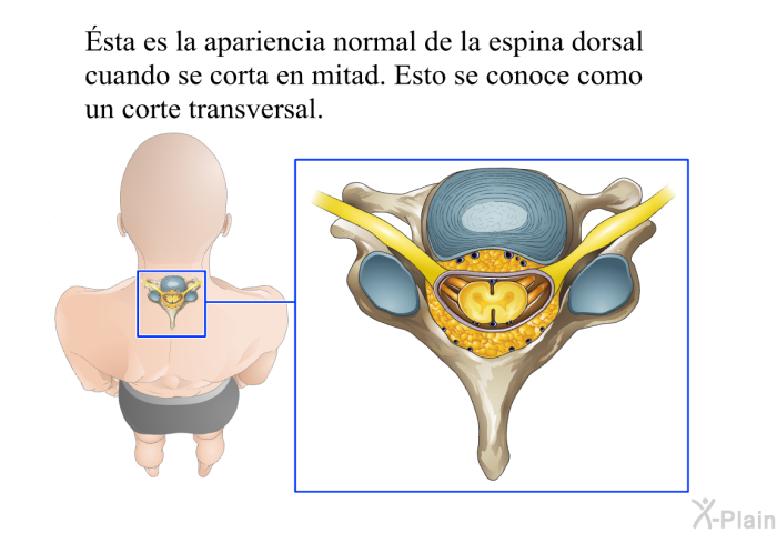 Ésta es la apariencia normal de la espina dorsal cuando se corta en mitad. Esto se conoce como un corte transversal.