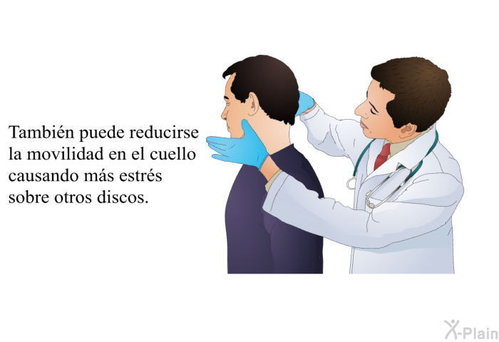 Tambi�n puede reducirse la movilidad en el cuello causando m�s estr�s sobre otros discos.