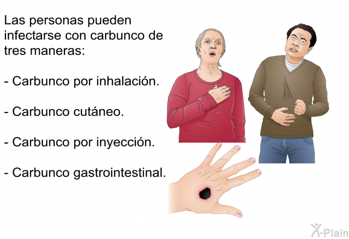 Las personas pueden infectarse con carbunco de tres maneras:  Carbunco por inhalacin. Carbunco cutneo. Carbunco por inyeccin. Carbunco gastrointestinal.