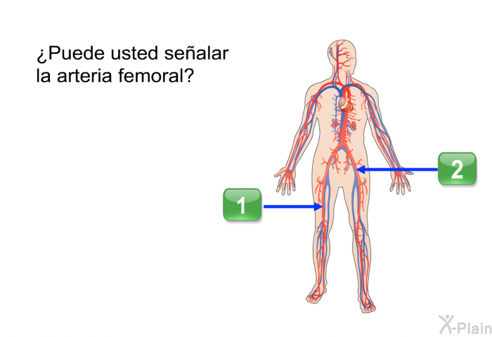 ¿Puede usted sealar la arteria femoral?