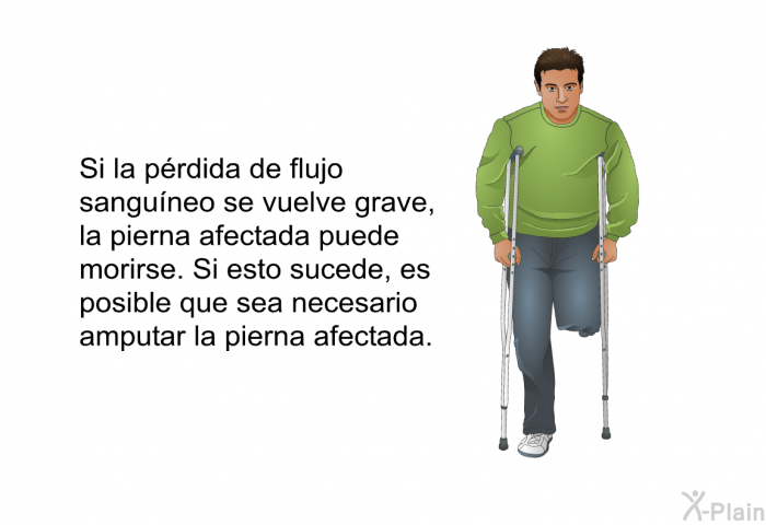 Si la prdida de flujo sanguneo se vuelve grave, la pierna afectada puede morirse. Si esto sucede, es posible que sea necesario amputar la pierna afectada.