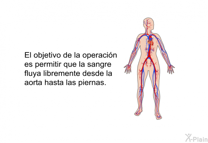 El objetivo de la operacin es permitir que la sangre fluya libremente desde la aorta hasta las piernas.