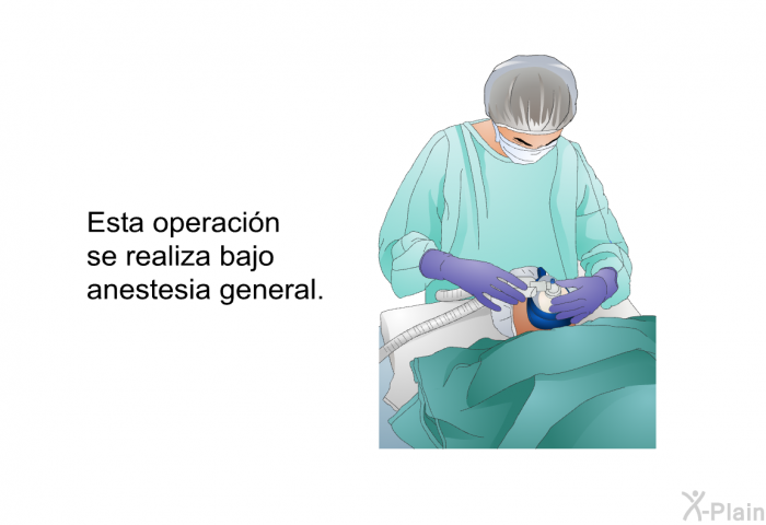 Esta operacin se realiza bajo anestesia general.