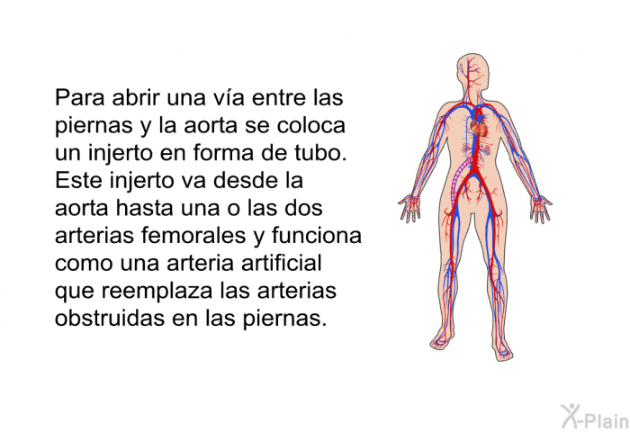 Para abrir una va entre las piernas y la aorta se coloca un injerto en forma de tubo. Este injerto va desde la aorta hasta una o las dos arterias femorales y funciona como una arteria artificial que reemplaza las arterias obstruidas en las piernas.