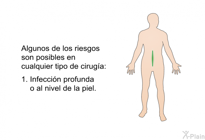 Algunos de los riesgos son posibles en cualquier tipo de ciruga:  Infeccin profunda o al nivel de la piel.