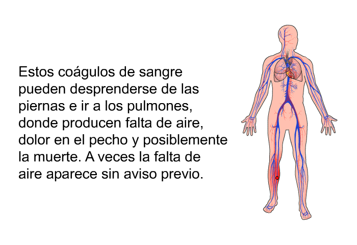 Estos cogulos de sangre pueden desprenderse de las piernas e ir a los pulmones, donde producen falta de aire, dolor en el pecho y posiblemente la muerte. A veces la falta de aire aparece sin aviso previo.