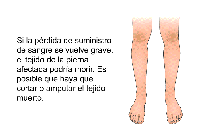 Si la prdida de suministro de sangre se vuelve grave, el tejido de la pierna afectada podra morir. Es posible que haya que cortar o amputar el tejido muerto.