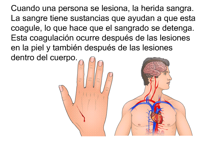 Cuando una persona se lesiona, la herida sangra. La sangre tiene sustancias que ayudan a que esta coagule, lo que hace que el sangrado se detenga. Esta coagulacin ocurre despus de las lesiones en la piel y tambin despus de las lesiones dentro del cuerpo.