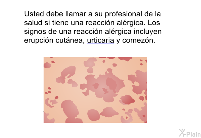 Usted debe llamar a su profesional de la salud si tiene una reaccin alrgica. Los signos de una reaccin alrgica incluyen erupcin cutnea, urticaria y comezn.