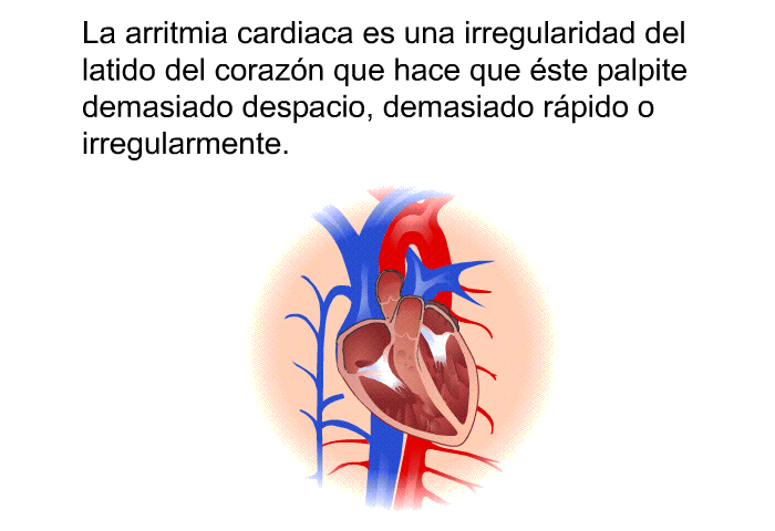 La arritmia cardiaca es una irregularidad del latido del corazn que hace que ste palpite demasiado despacio, demasiado rpido o irregularmente.