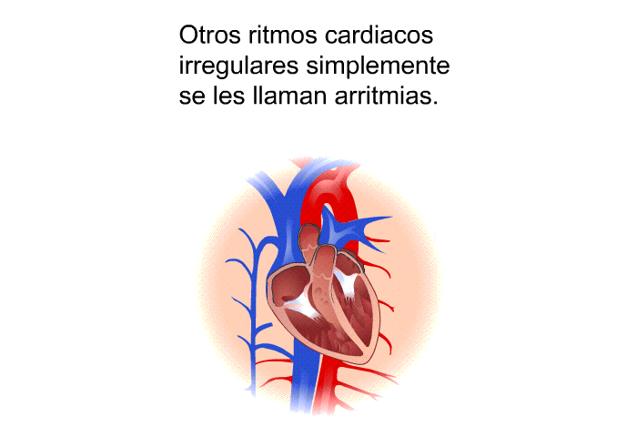 Otros ritmos cardiacos irregulares simplemente se les llaman arritmias.
