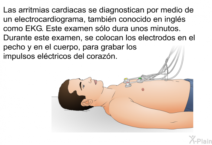 Las arritmias cardiacas se diagnostican por medio de un electrocardiograma, tambin conocido en ingls como EKG. Este examen slo dura unos minutos. Durante este examen, se colocan los electrodos en el pecho y en el cuerpo, para grabar los impulsos elctricos del corazn.