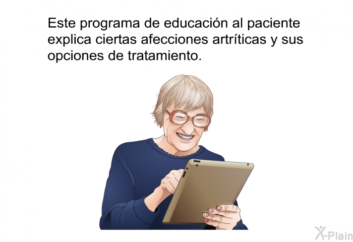 Esta informacin acerca de su salud explica ciertas afecciones artrticas y sus opciones de tratamiento.