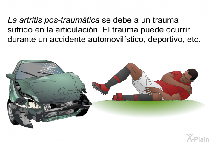 <I>La artritis pos-traumtica </I>se debe a un trauma sufrido en la articulacin. El trauma puede ocurrir durante un accidente automovilstico, deportivo, etc.