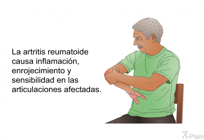 La artritis reumatoide causa inflamaci�n, enrojecimiento y sensibilidad en las articulaciones afectadas.