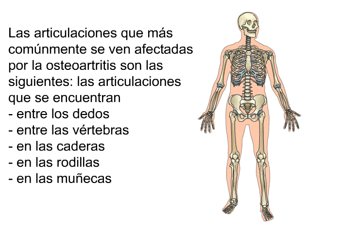 Las articulaciones que m�s com�nmente se ven afectadas por la <B>osteoartritis</B> son las siguientes:  las articulaciones que se encuentran entre los dedos entre las v�rtebras en las caderas en las rodillas en las mu�ecas