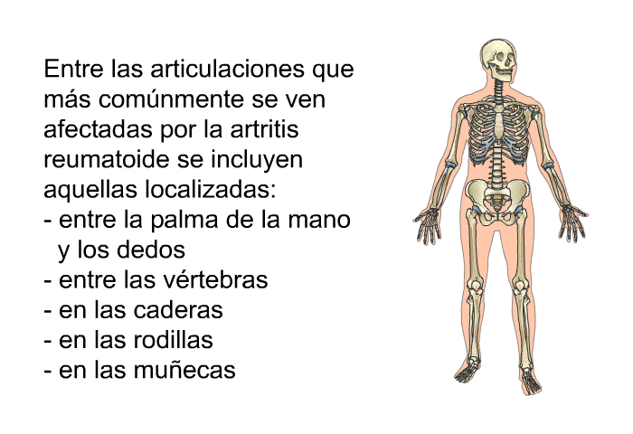 Entre las articulaciones que m�s com�nmente se ven afectadas por la artritis reumatoide se incluyen:  aquellas localizadas entre la palma de la mano y los dedos entre las v�rtebras en las caderas en las rodillas en las mu�ecas