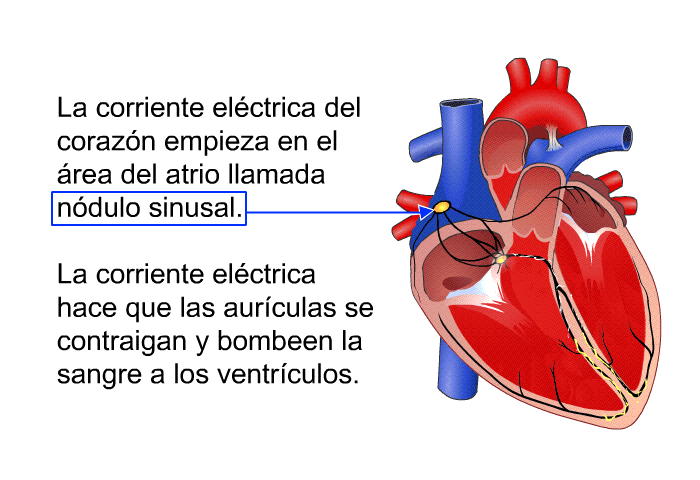 La corriente elctrica del corazn empieza en el rea del atrio llamada ndulo sinusal. La corriente elctrica hace que las aurculas se contraigan y bombeen la sangre a los ventrculos.