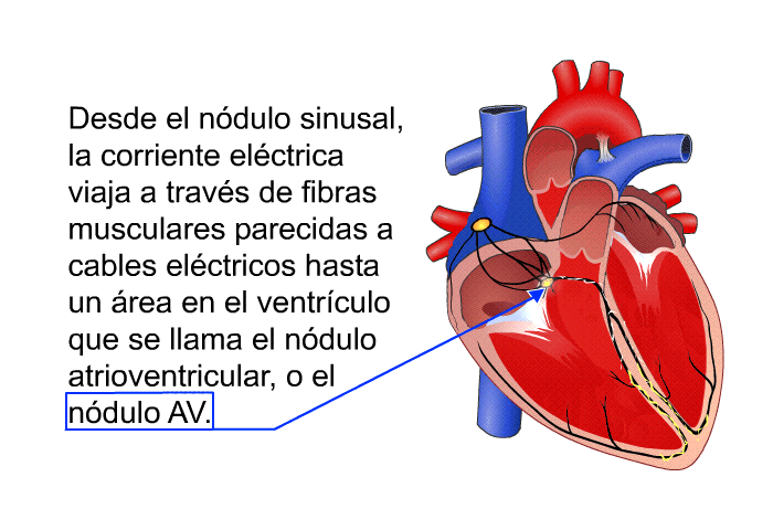 Desde el ndulo sinusal, la corriente elctrica viaja a travs de fibras musculares parecidas a cables elctricos hasta un rea en el ventrculo que se llama el ndulo atrioventricular, o el ndulo AV.