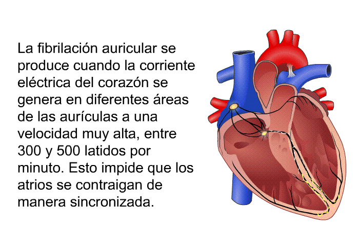 La fibrilación auricular se produce cuando la corriente eléctrica del corazón se genera en diferentes áreas de las aurículas a una velocidad muy alta, entre 300 y 500 latidos por minuto. Esto impide que los atrios se contraigan de manera sincronizada.