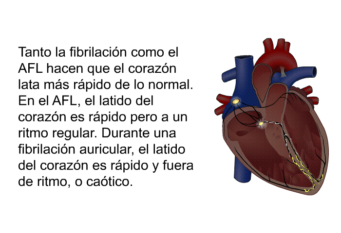 Tanto la fibrilacin como el AFL hacen que el corazn lata ms rpido de lo normal. En el AFL, el latido del corazn es rpido pero a un ritmo regular. Durante una fibrilacin auricular, el latido del corazn es rpido y fuera de ritmo, o catico.