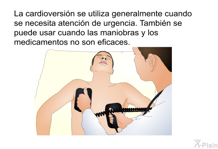 La cardioversi�n se utiliza generalmente cuando se necesita atenci�n de urgencia. Tambi�n se puede usar cuando las maniobras y los medicamentos no son eficaces.