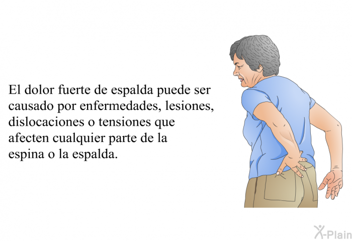 El dolor fuerte de espalda puede ser causado por enfermedades, lesiones, dislocaciones o tensiones que afecten cualquier parte de la espina o la espalda.