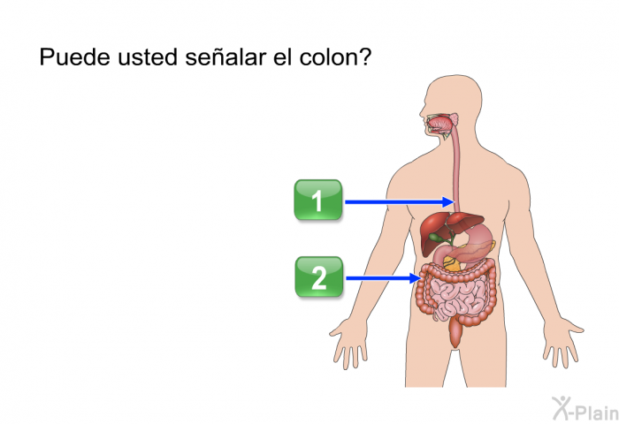 ¿Puede usted sealar el colon?