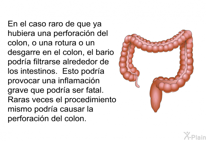 En el caso raro de que ya hubiera una perforacin del colon, o una rotura o un desgarre en el colon, el bario podra filtrarse alrededor de los intestinos. Esto podra provocar una inflamacin grave que podra ser fatal. Raras veces el procedimiento mismo podra causar la perforacin del colon.