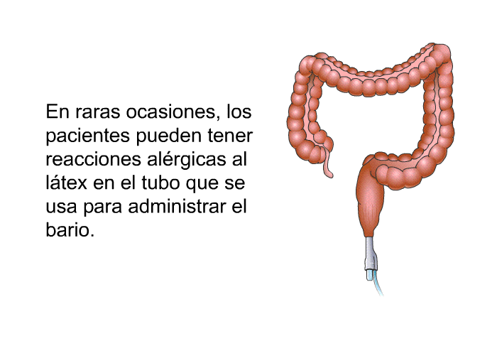 En raras ocasiones, los pacientes pueden tener reacciones alrgicas al ltex en el tubo que se usa para administrar el bario.