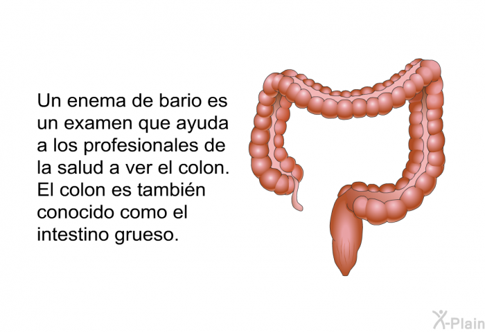 Un enema de bario es un examen que ayuda a los profesionales de la salud a ver el colon. El colon es tambin conocido como el intestino grueso.