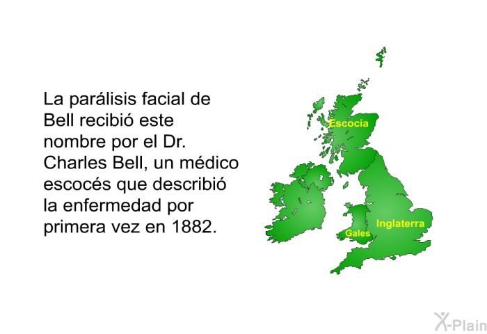 La parlisis facial de Bell recibi este nombre por el Dr. Charles Bell, un mdico escocs que describi la enfermedad por primera vez en 1882.