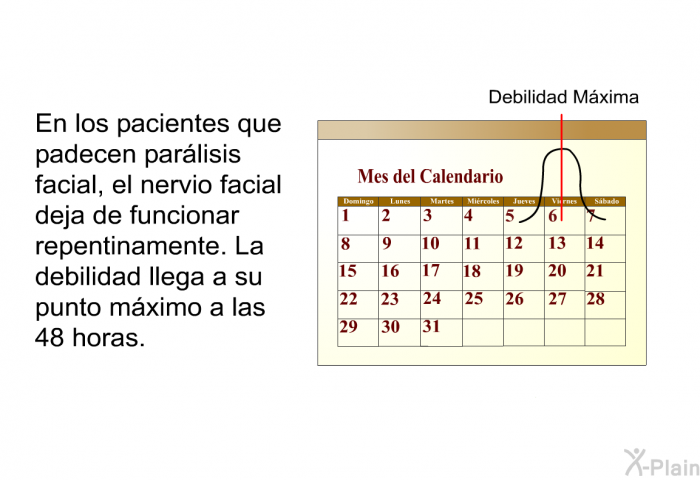 En los pacientes que padecen parlisis facial, el nervio facial deja de funcionar repentinamente. La debilidad llega a su punto mximo a las 48 horas.