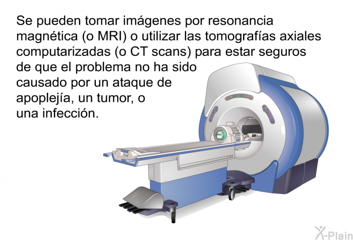 Se pueden tomar im�genes por resonancia magn�tica (o MRI) o utilizar las tomograf�as axiales computarizadas (o CT scans) para estar seguros de que el problema no ha sido causado por un ataque de apoplej�a, un tumor, o una infecci�n.